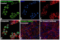 Phospho-DNM1L (Ser616) Recombinant Rabbit Monoclonal Antibody (PSH06-77):Antibodies,
