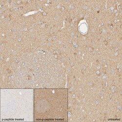 Phospho-DNM1L (Ser616) Recombinant Rabbit Monoclonal Antibody (PSH06-77):Antibodies,