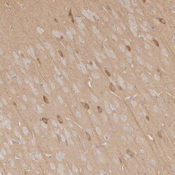 Phospho-DNM1L (Ser616) Recombinant Rabbit Monoclonal Antibody (PSH06-77):Antibodies,