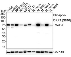 Phospho-DNM1L (Ser616) Recombinant Rabbit Monoclonal Antibody (PSH06-77):Antibodies,
