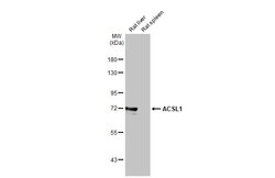 Invitrogen ACSL1 Recombinant Rabbit Monoclonal Antibody (HL1651) 100 &mu;L;