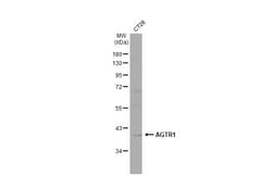 Invitrogen AGTR1 Recombinant Rabbit Monoclonal Antibody (HL2524) 100 &mu;L;