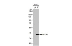 Invitrogen AGTR1 Recombinant Rabbit Monoclonal Antibody (HL2524) 100 &mu;L;