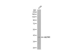 Invitrogen AGTR1 Recombinant Rabbit Monoclonal Antibody (HL2526) 100 &mu;L;