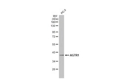 Invitrogen AGTR1 Recombinant Rabbit Monoclonal Antibody (HL2526) 100 &mu;L;