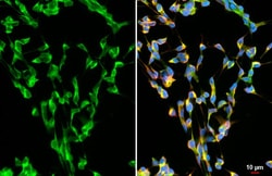 Invitrogen alpha Synuclein Recombinant Rabbit Monoclonal Antibody (HL1243)