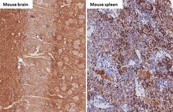 Invitrogen alpha Synuclein Recombinant Rabbit Monoclonal Antibody (HL1243)