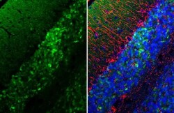Invitrogen alpha Synuclein Recombinant Rabbit Monoclonal Antibody (HL1243)