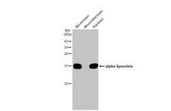Invitrogen alpha Synuclein Recombinant Rabbit Monoclonal Antibody (HL1243)