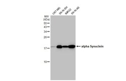 Invitrogen alpha Synuclein Recombinant Rabbit Monoclonal Antibody (HL1243)