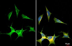 Invitrogen ANP Recombinant Rabbit Monoclonal Antibody (HL2617) 100 &mu;L;