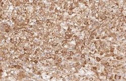 Invitrogen Apelin Receptor Recombinant Rabbit Monoclonal Antibody (HL2980)