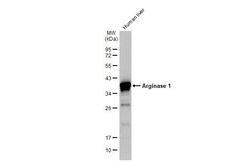 Invitrogen Arginase 1 Recombinant Rabbit Monoclonal Antibody (HL1891) 100