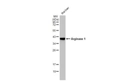 Invitrogen Arginase 1 Recombinant Rabbit Monoclonal Antibody (HL1891) 100