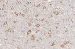 Invitrogen Ataxin 2 Recombinant Rabbit Monoclonal Antibody (HL2885) 100