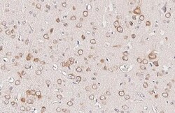 Invitrogen Ataxin 2 Recombinant Rabbit Monoclonal Antibody (HL2886) 100