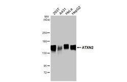 Invitrogen Ataxin 2 Recombinant Rabbit Monoclonal Antibody (HL2886) 100