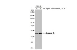 Invitrogen Aurora A Recombinant Rabbit Monoclonal Antibody (HL2917) 100