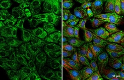 Invitrogen BCL-XL Recombinant Rabbit Monoclonal Antibody (HL2038) 100 &mu;L;