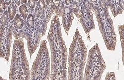 Invitrogen BCL-XL Recombinant Rabbit Monoclonal Antibody (HL2038) 100 &mu;L;