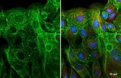 Invitrogen BCL-XL Recombinant Rabbit Monoclonal Antibody (HL2039) 100 &mu;L;
