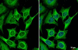 Invitrogen BCL-XL Recombinant Rabbit Monoclonal Antibody (HL2039) 100 &mu;L;
