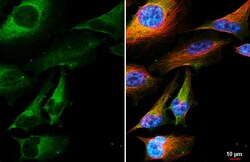 Invitrogen Beclin 1 Recombinant Rabbit Monoclonal Antibody (HL3130) 100