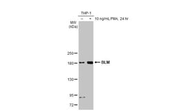 Invitrogen Blooms Syndrome Recombinant Rabbit Monoclonal Antibody (HL2771)