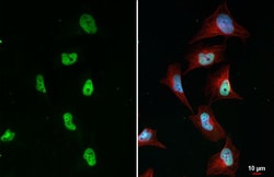 Invitrogen BRD4 Recombinant Rabbit Monoclonal Antibody (HL2729) 100 &mu;L;
