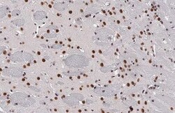 Invitrogen BRD4 Recombinant Rabbit Monoclonal Antibody (HL2729) 100 &mu;L;