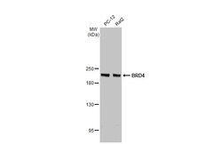 Invitrogen BRD4 Recombinant Rabbit Monoclonal Antibody (HL2729) 100 &mu;L;