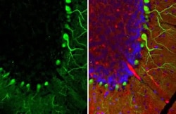 Invitrogen Calbindin D28K Recombinant Rabbit Monoclonal Antibody (HL2378)