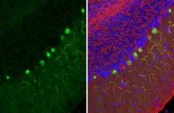 Invitrogen Calbindin D28K Recombinant Rabbit Monoclonal Antibody (HL2378)