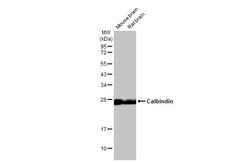Invitrogen Calbindin D28K Recombinant Rabbit Monoclonal Antibody (HL2378)