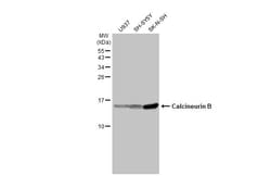 Invitrogen Calcineurin B Recombinant Rabbit Monoclonal Antibody (HL2419)