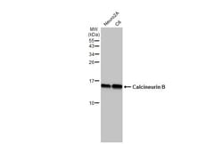 Invitrogen Calcineurin B Recombinant Rabbit Monoclonal Antibody (HL2419)