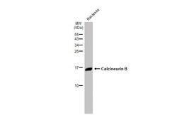 Invitrogen Calcineurin B Recombinant Rabbit Monoclonal Antibody (HL2419)