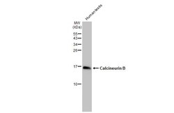 Invitrogen Calcineurin B Recombinant Rabbit Monoclonal Antibody (HL2419)