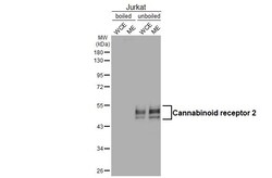 Invitrogen CNR2 Recombinant Rabbit Monoclonal Antibody (HL3120) 100 &mu;L;