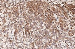 Invitrogen CCR1 Recombinant Rabbit Monoclonal Antibody (HL3023) 100 &mu;L;