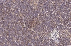 Invitrogen CCR1 Recombinant Rabbit Monoclonal Antibody (HL3023) 100 &mu;L;