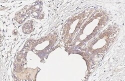 Invitrogen CCR1 Recombinant Rabbit Monoclonal Antibody (HL3034) 100 &mu;L;