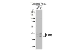 Invitrogen CCR1 Recombinant Rabbit Monoclonal Antibody (HL3034) 100 &mu;L;