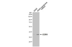 Invitrogen CCR1 Recombinant Rabbit Monoclonal Antibody (HL3034) 100 &mu;L;