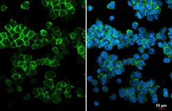 Invitrogen CCR2 Recombinant Rabbit Monoclonal Antibody (HL2838) 100 &mu;L;