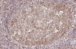 Invitrogen CCR7 Recombinant Rabbit Monoclonal Antibody (HL3074) 100 &mu;L;