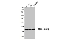 Invitrogen CDK4/CDK6 Recombinant Rabbit Monoclonal Antibody (HL2323) 100
