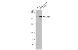 Invitrogen CHD4 Recombinant Rabbit Monoclonal Antibody (HL1798) 100 &mu;L;
