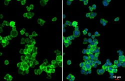 Invitrogen CHI3L1 Recombinant Rabbit Monoclonal Antibody (HL2708) 100 &mu;L;