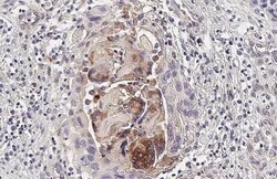 Invitrogen CHI3L1 Recombinant Rabbit Monoclonal Antibody (HL2708) 100 &mu;L;